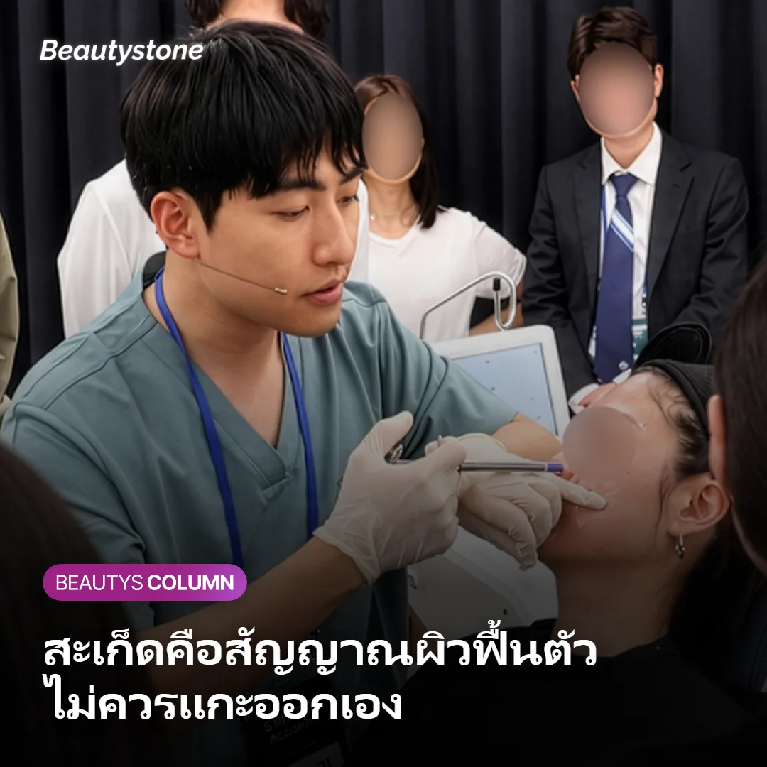 ภาพแสดงกลไกการเกิดสะเก็ดและผิวลอกหลังทำเลเซอร์