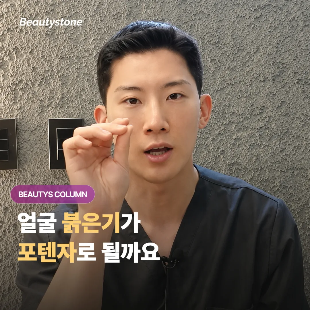 얼굴 붉은기가 잘 안 가라앉을 때, 포텐자 같은 마이크로니들 RF는 어디까지 도움이 될까요?