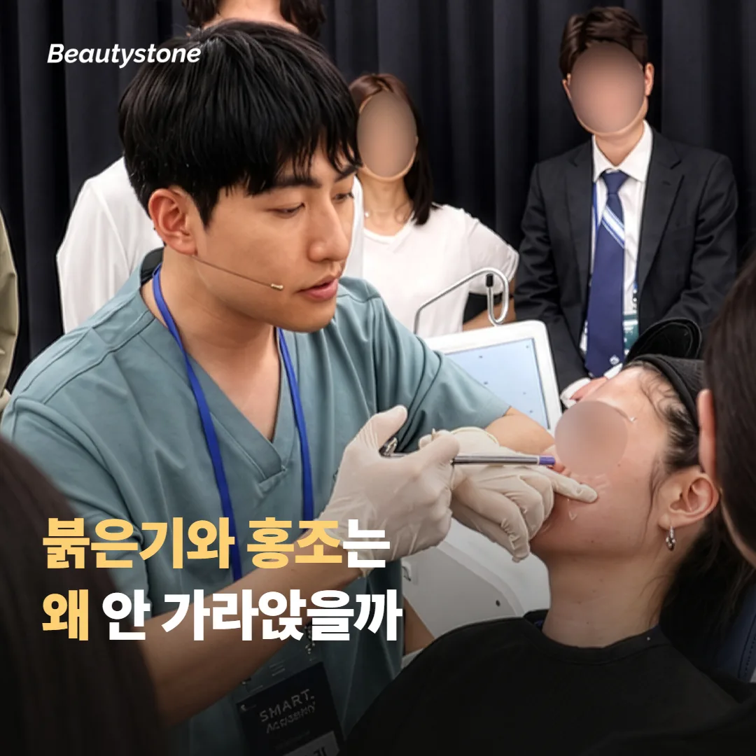 붉은기와 홍조는 왜 잘 안 가라앉을까요