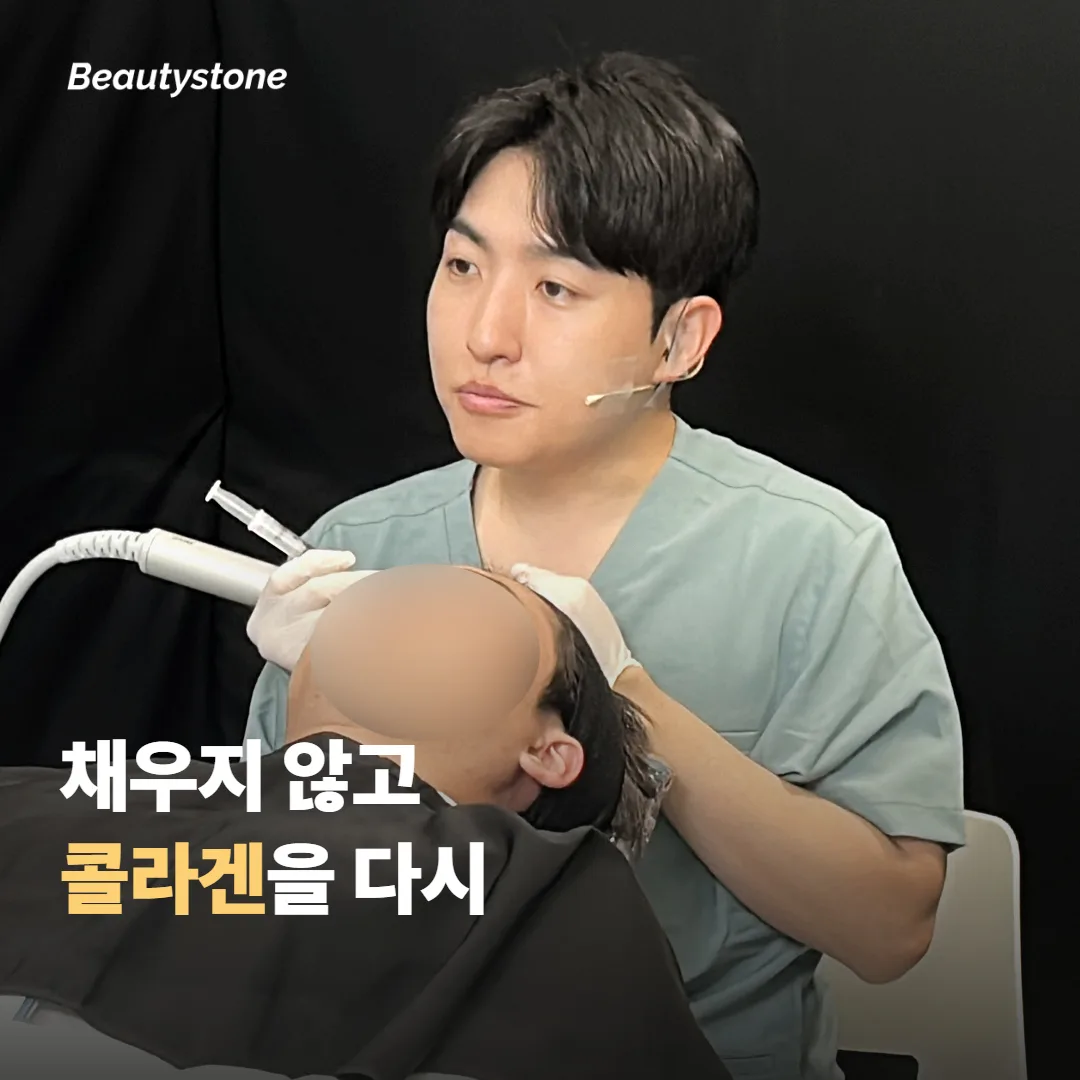 스컬트라는 채우는 게 아니라 콜라겐을 다시 만들게 해요