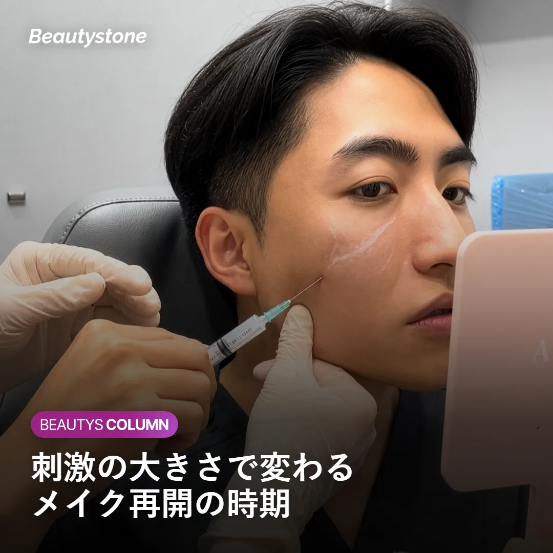 施術タイプ別のメイク再開時期の目安を示す図