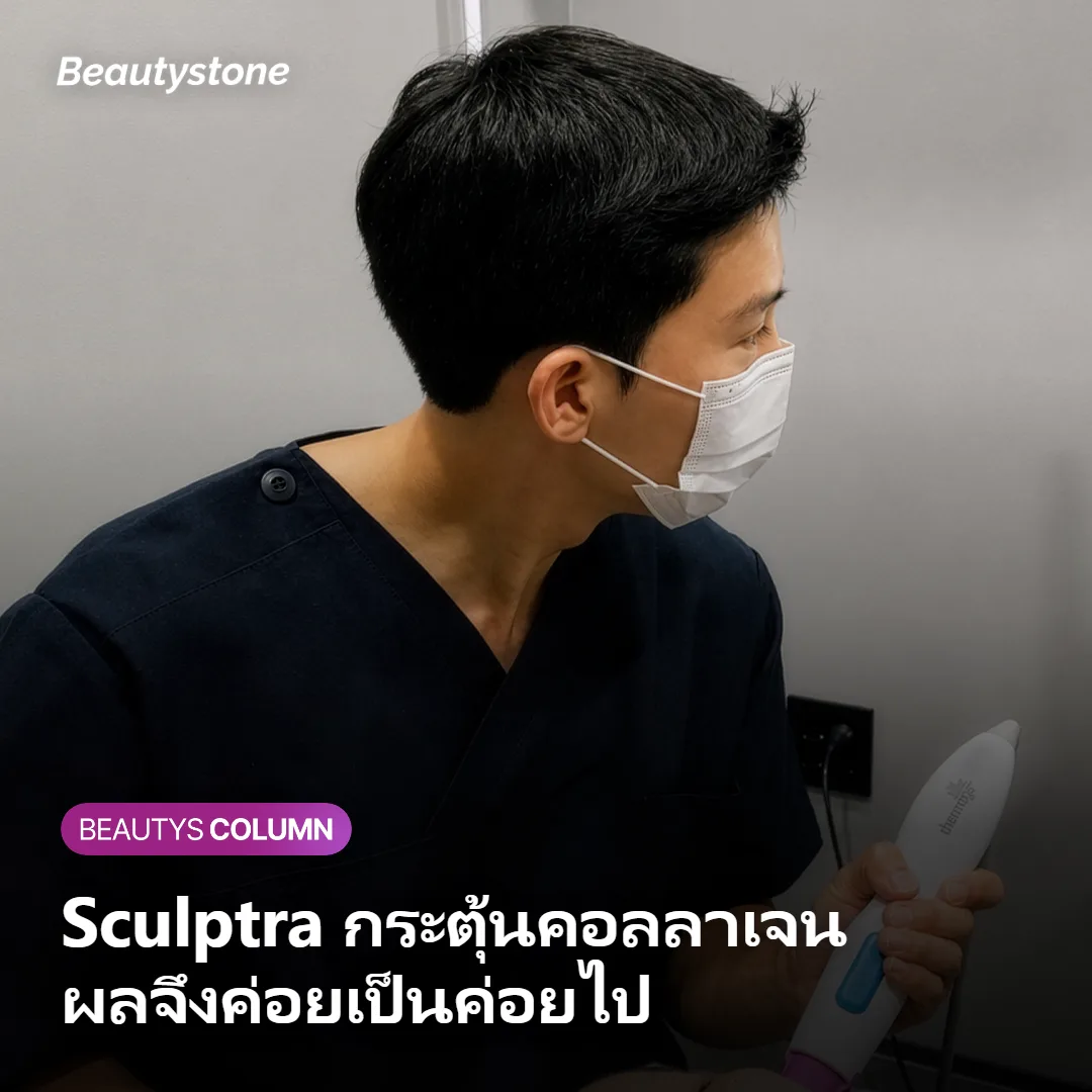 ภาพแสดงกลไกการกระตุ้นการสร้างคอลลาเจนของ Sculptra