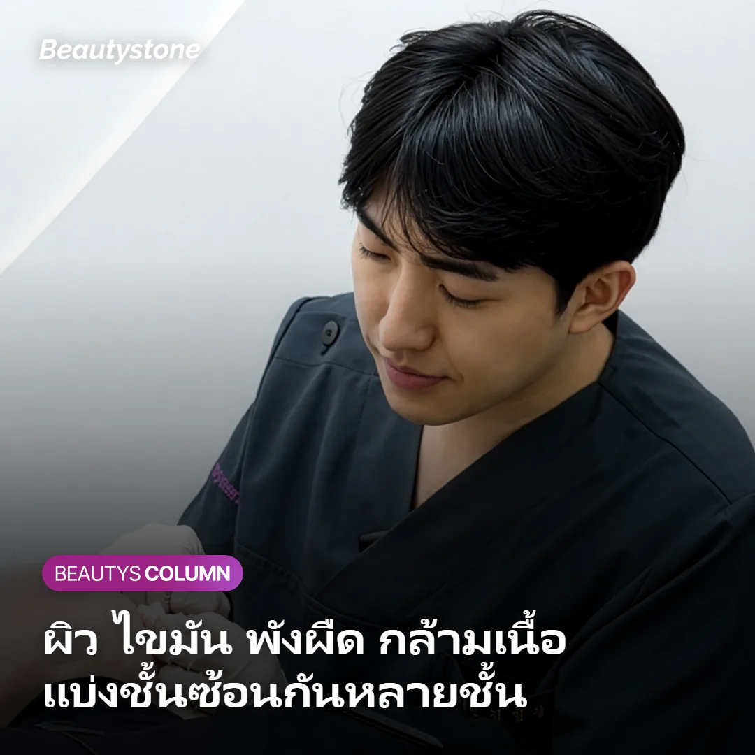 ภาพแสดงโครงสร้างชั้นของสะโพกและตำแหน่งฟิลเลอร์ในชั้นไขมันลึกเหนือพังผืด