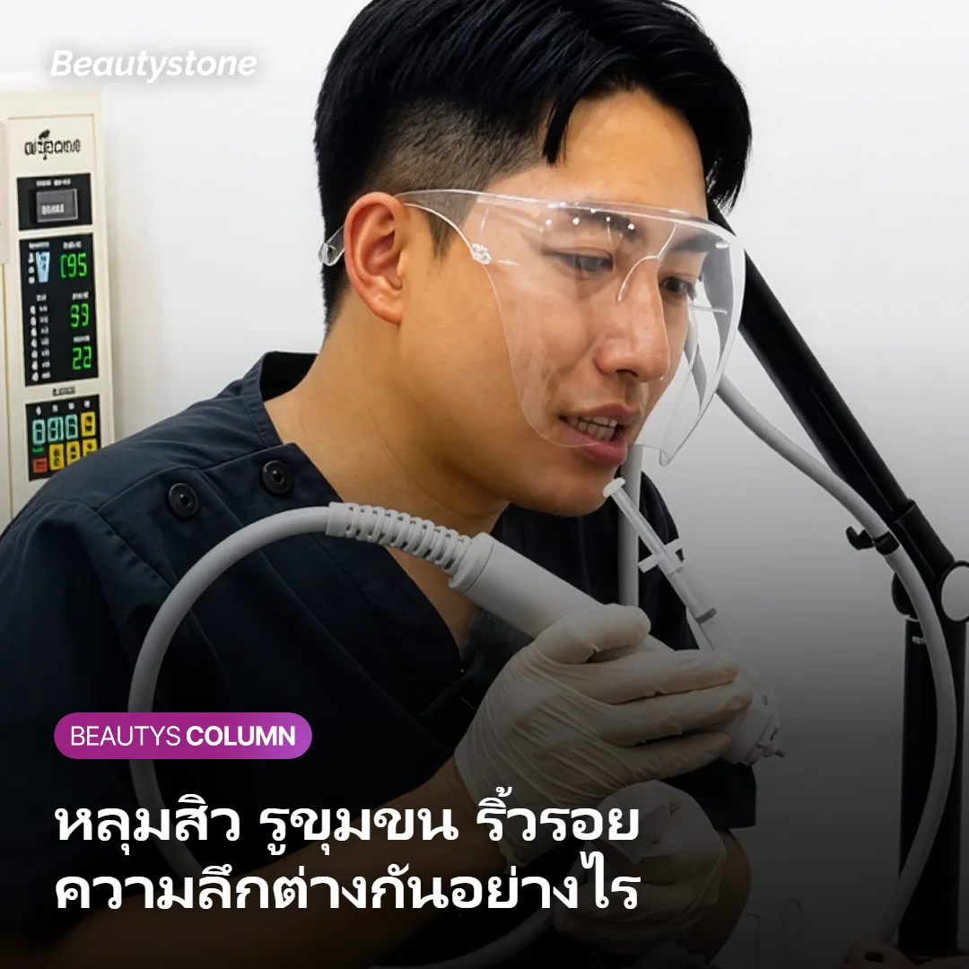 ภาพแสดงความลึกและชั้นเป้าหมายของหลุมสิว รูขุมขน และริ้วรอย
