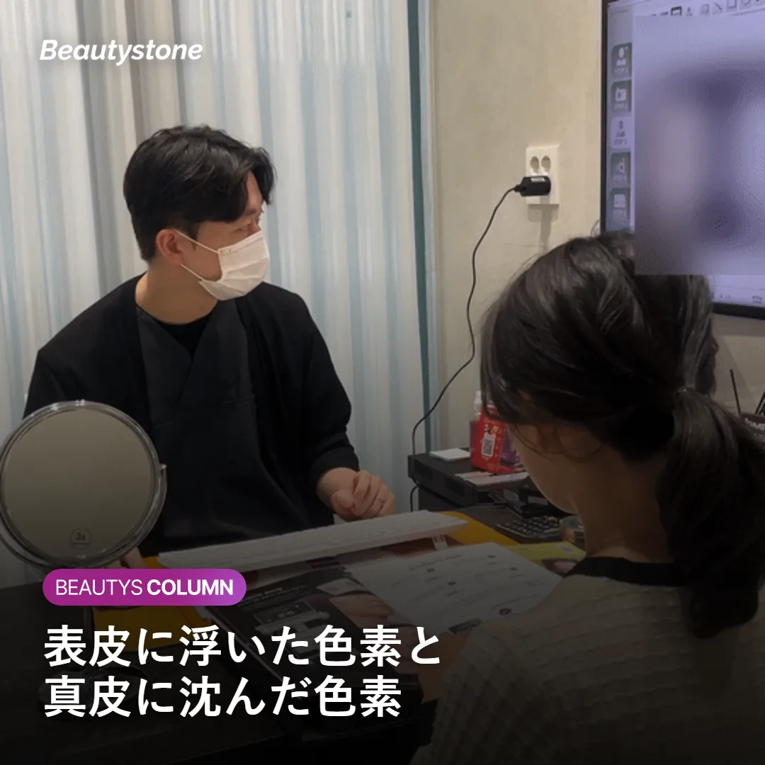 表皮に浅く浮いた色素と真皮に沈んだ色素の深さの違いを示す図