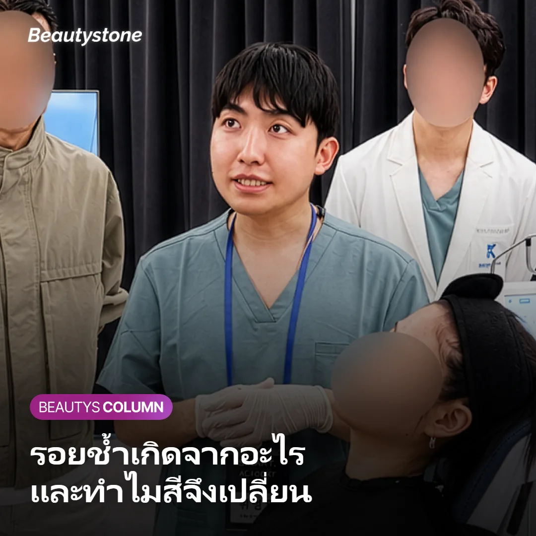 ภาพแสดงเส้นเลือดฝอยใต้ผิวที่แตกและเลือดซึมออกมา