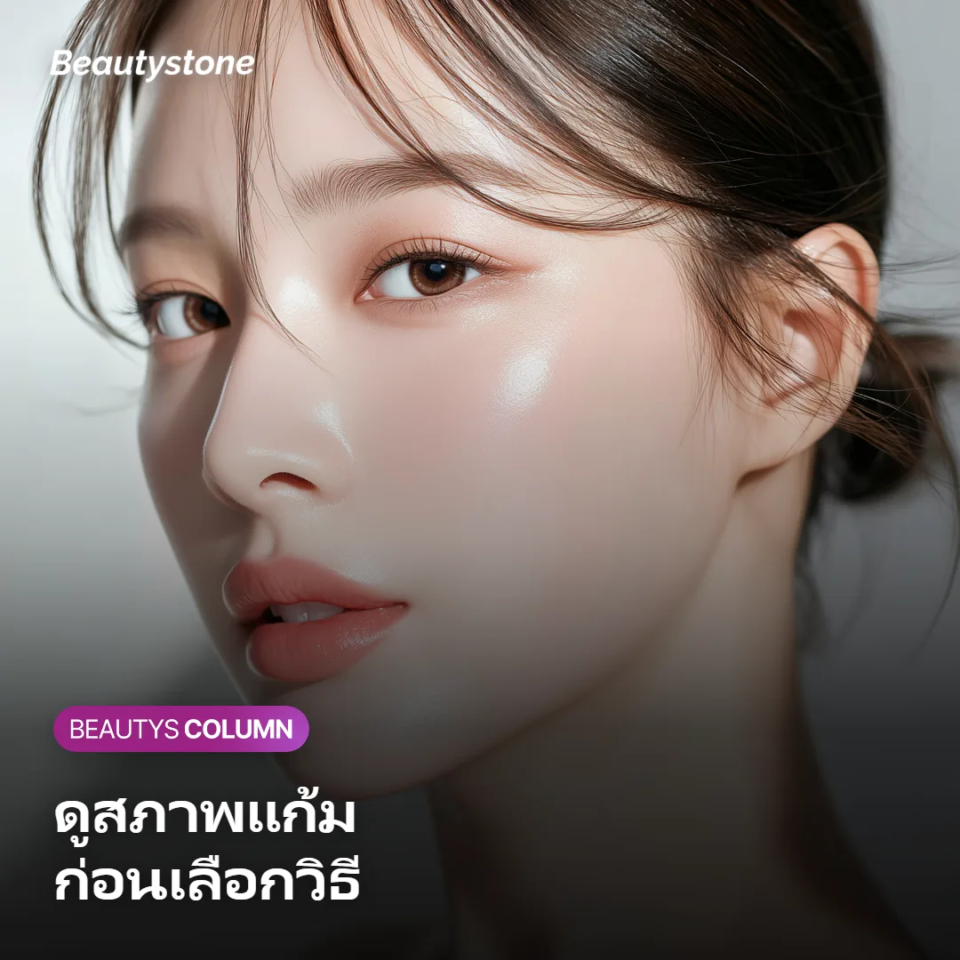 ภาพแสดงลักษณะแก้มตอบที่เหมาะกับ Juvelook หรือฟิลเลอร์