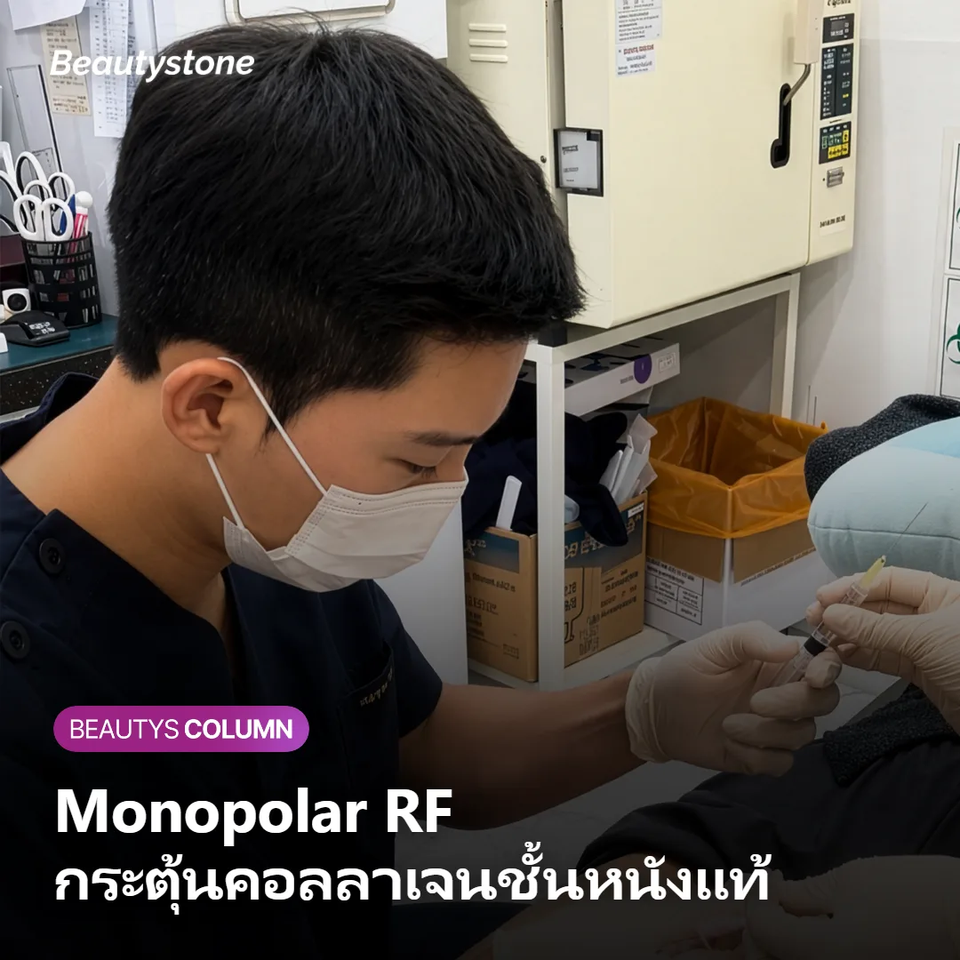 ภาพแสดงกลไก Monopolar RF ของ Oligio X ที่กระตุ้นคอลลาเจนในชั้นหนังแท้