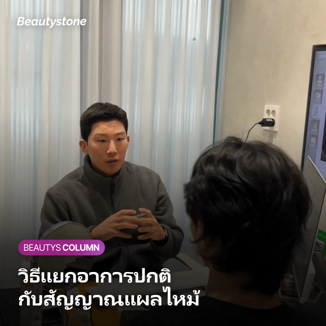 ภาพแสดงวิธีแยกอาการที่ดูเหมือนไหม้กับแผลไหม้จริง