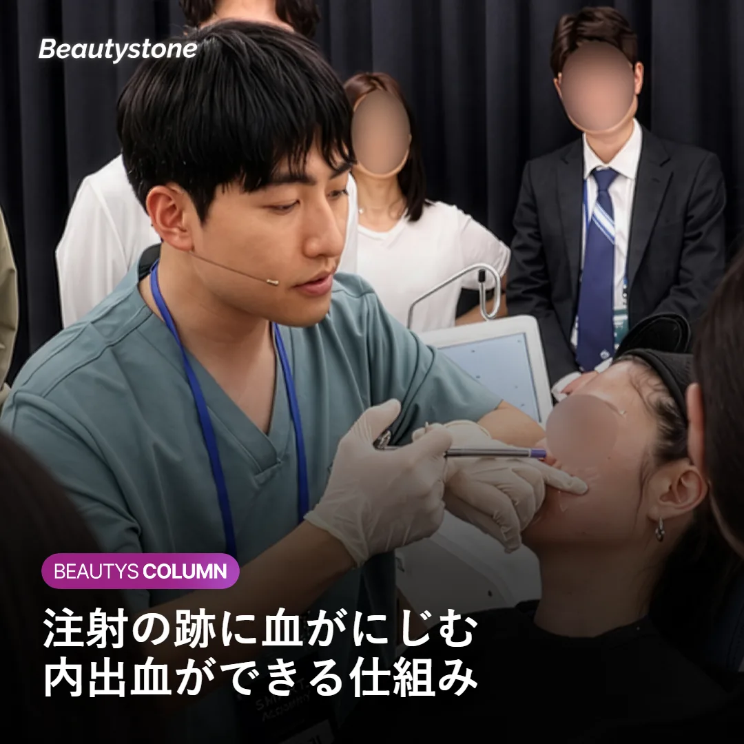 針が深い層へ注入され細い血管を通る構造を示す図