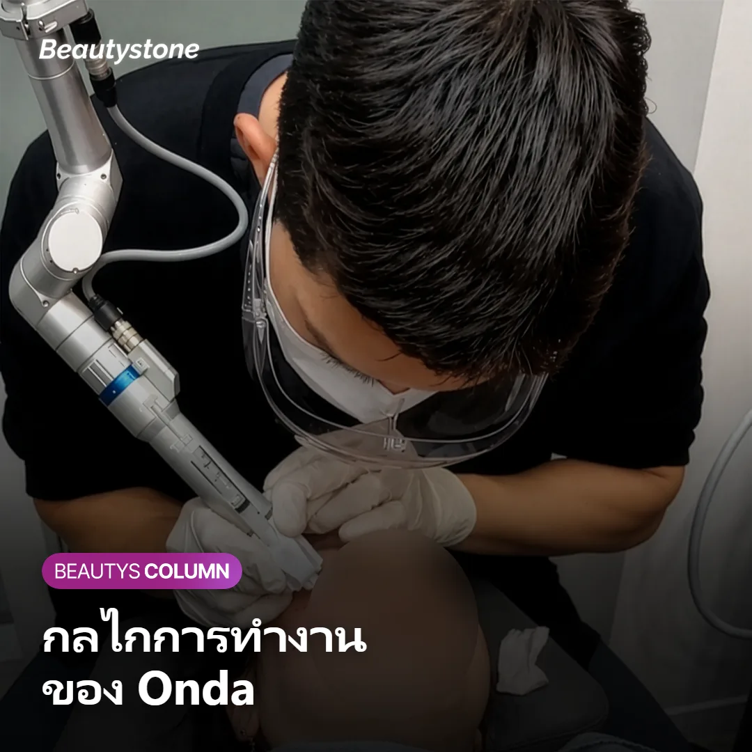 ภาพแสดงกลไกคลื่นไมโครเวฟส่งความร้อนสู่ชั้นผิวด้านล่างเพื่อกระตุ้นคอลลาเจน
