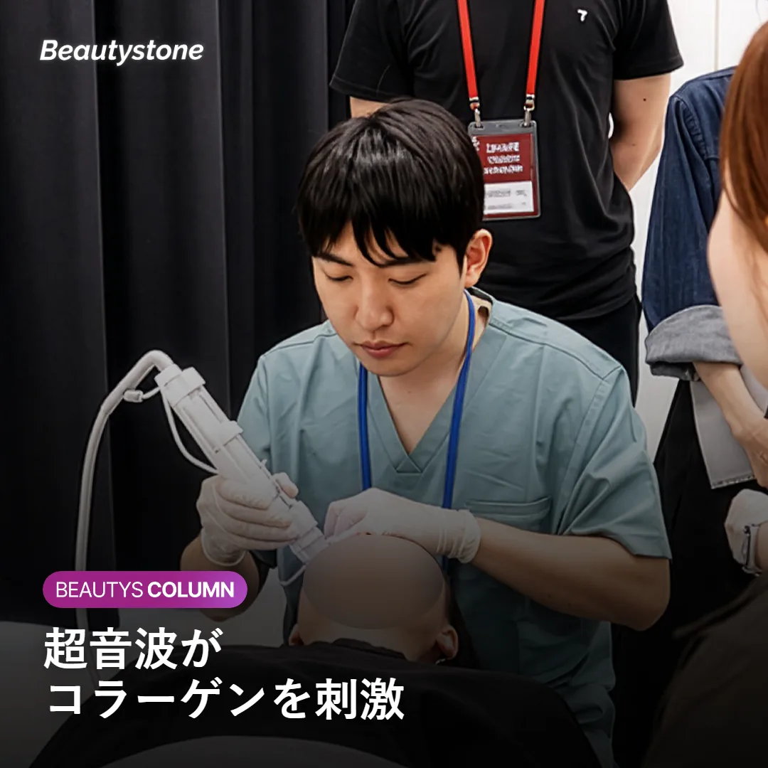 真皮層に届いた超音波エネルギーとコラーゲン刺激の仕組みを示す図