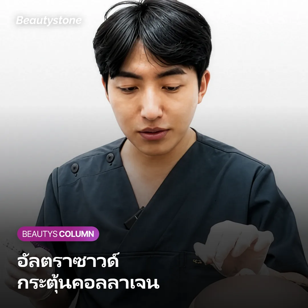 ภาพแสดงพลังงานอัลตราซาวด์ในชั้นผิวหนังแท้และการกระตุ้นคอลลาเจน