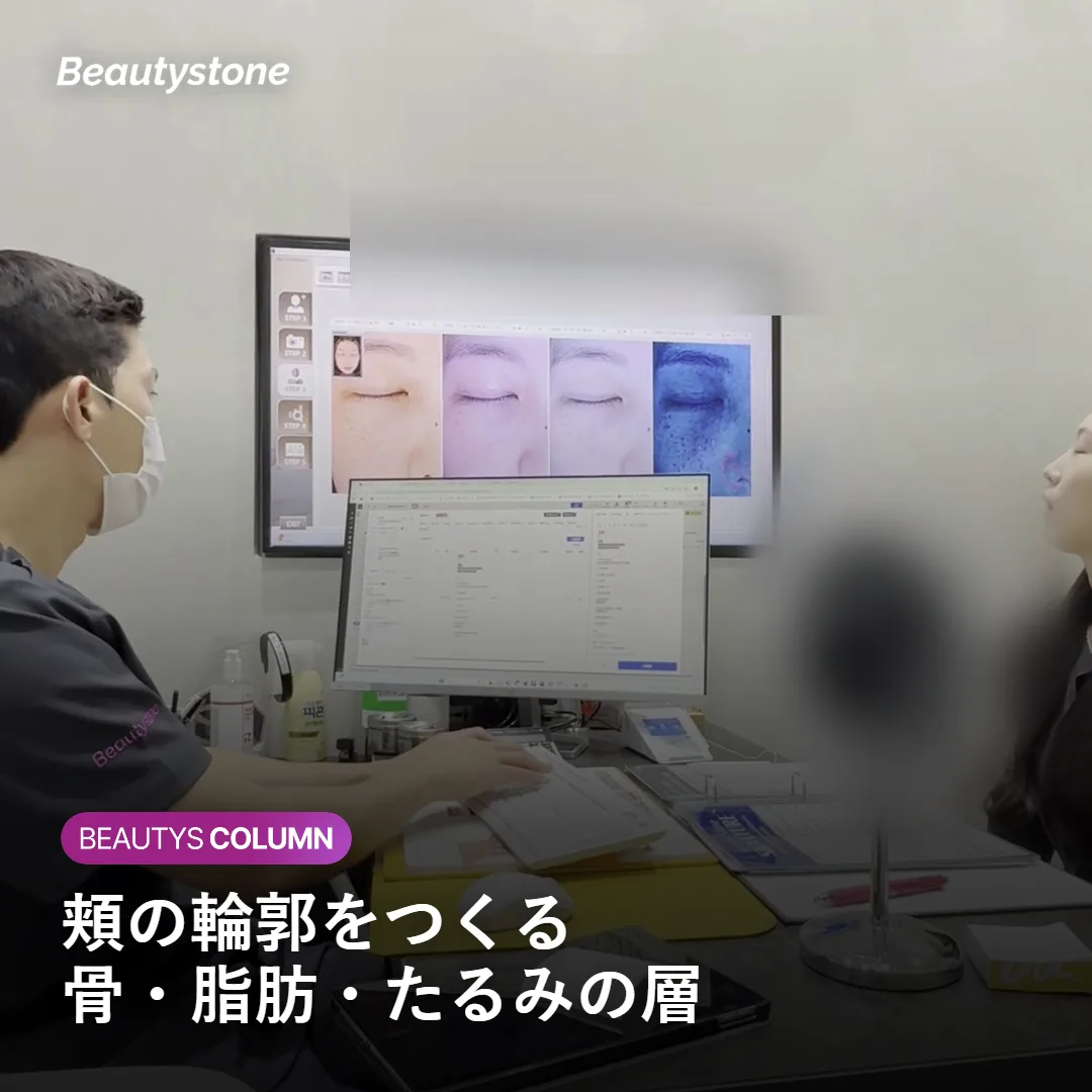 頬の輪郭をつくる骨・脂肪・たるみの層構造を示す図