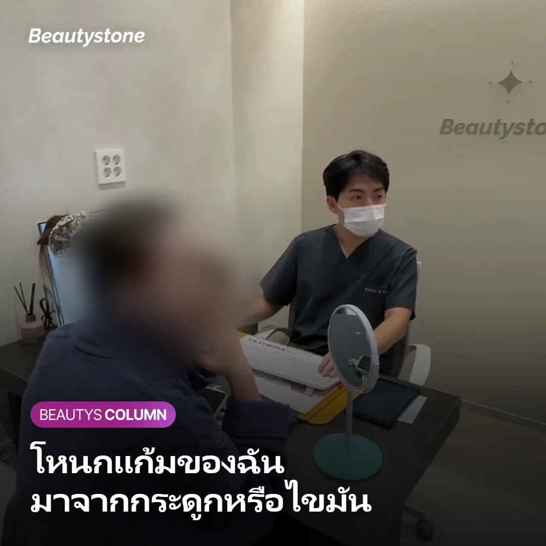 ภาพแสดงวิธีสังเกตว่าโหนกแก้มมาจากกระดูกหรือไขมัน
