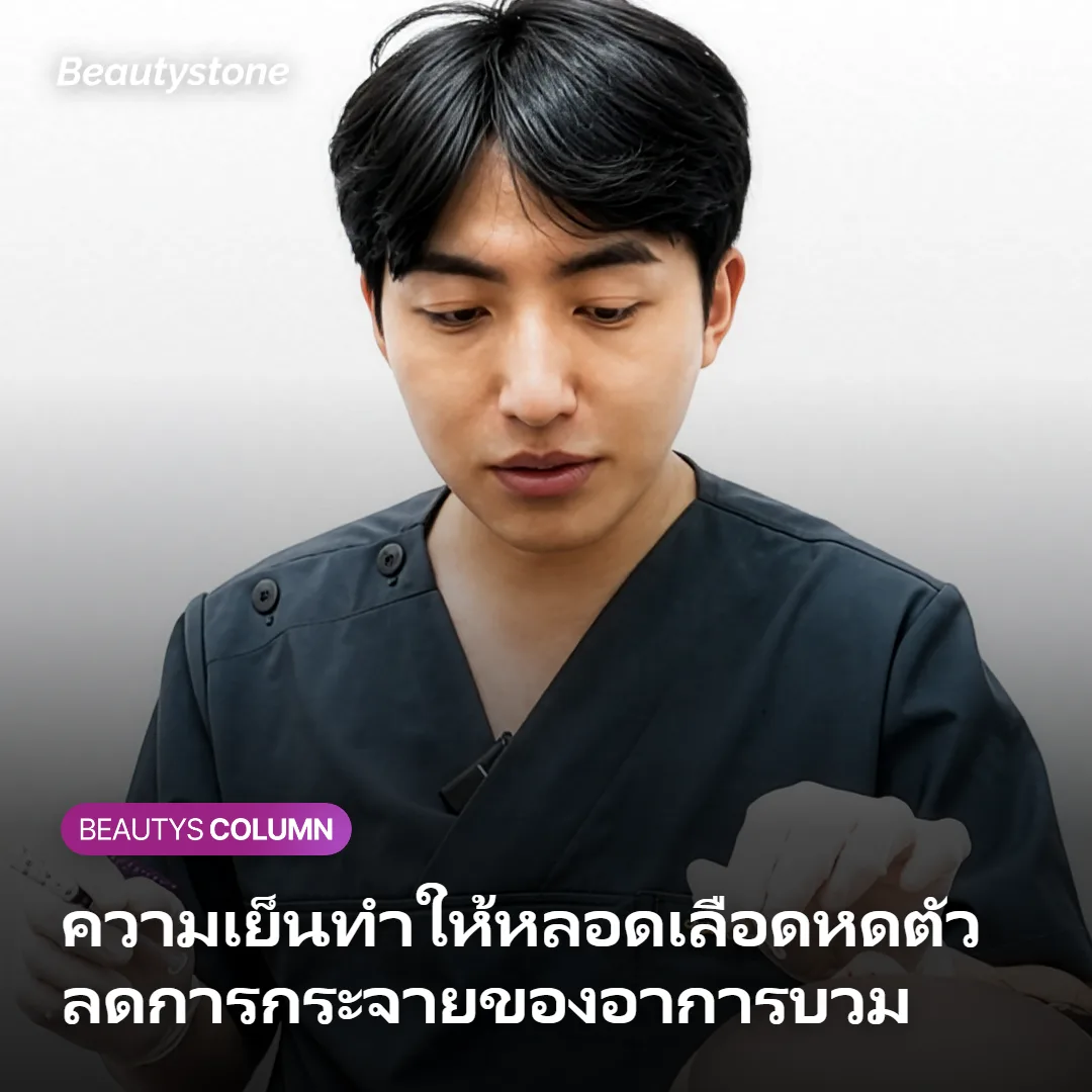 ภาพแสดงกลไกที่ความเย็นทำให้หลอดเลือดหดตัวและลดการกระจายของอาการบวม