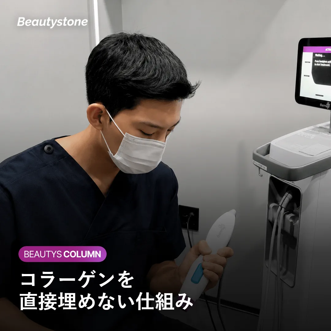皮下でコラーゲン生成を促すスカルプトラの仕組みを示す図