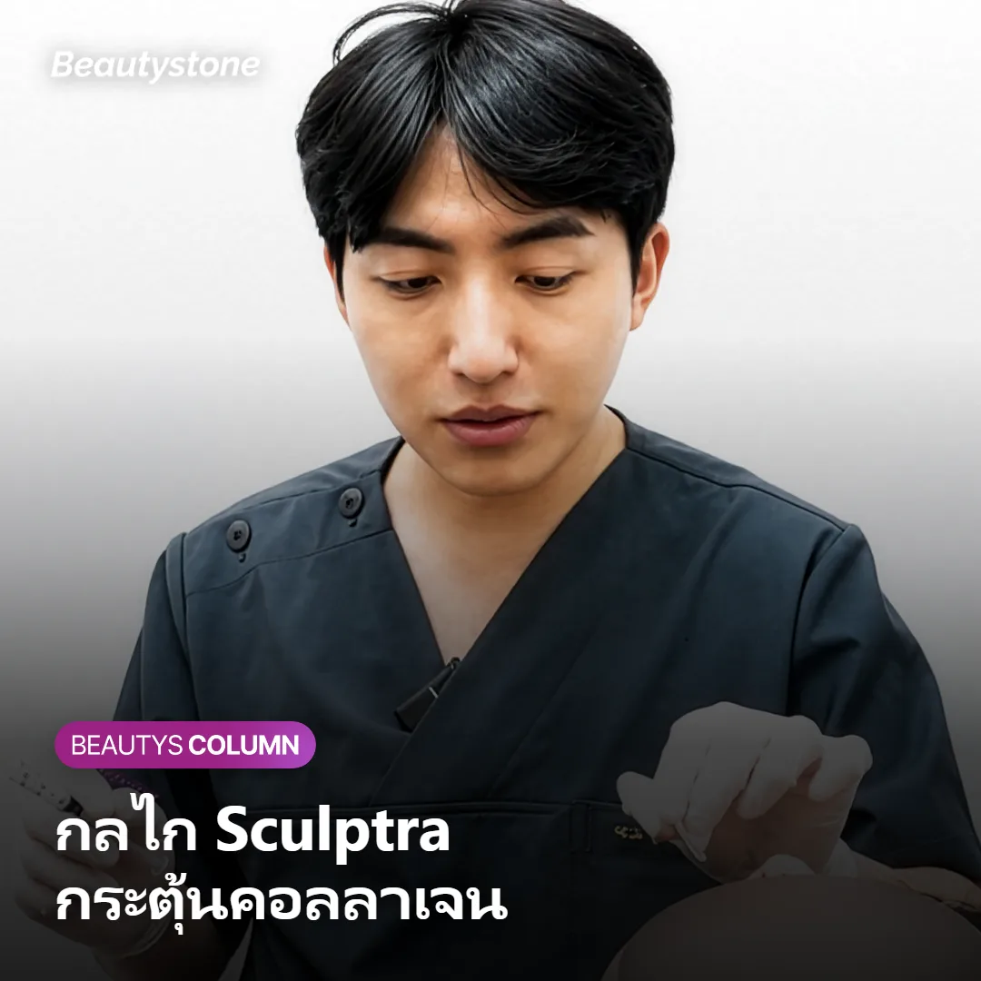 ภาพแสดงกลไก Sculptra ที่กระตุ้นการสร้างคอลลาเจนใต้ผิว