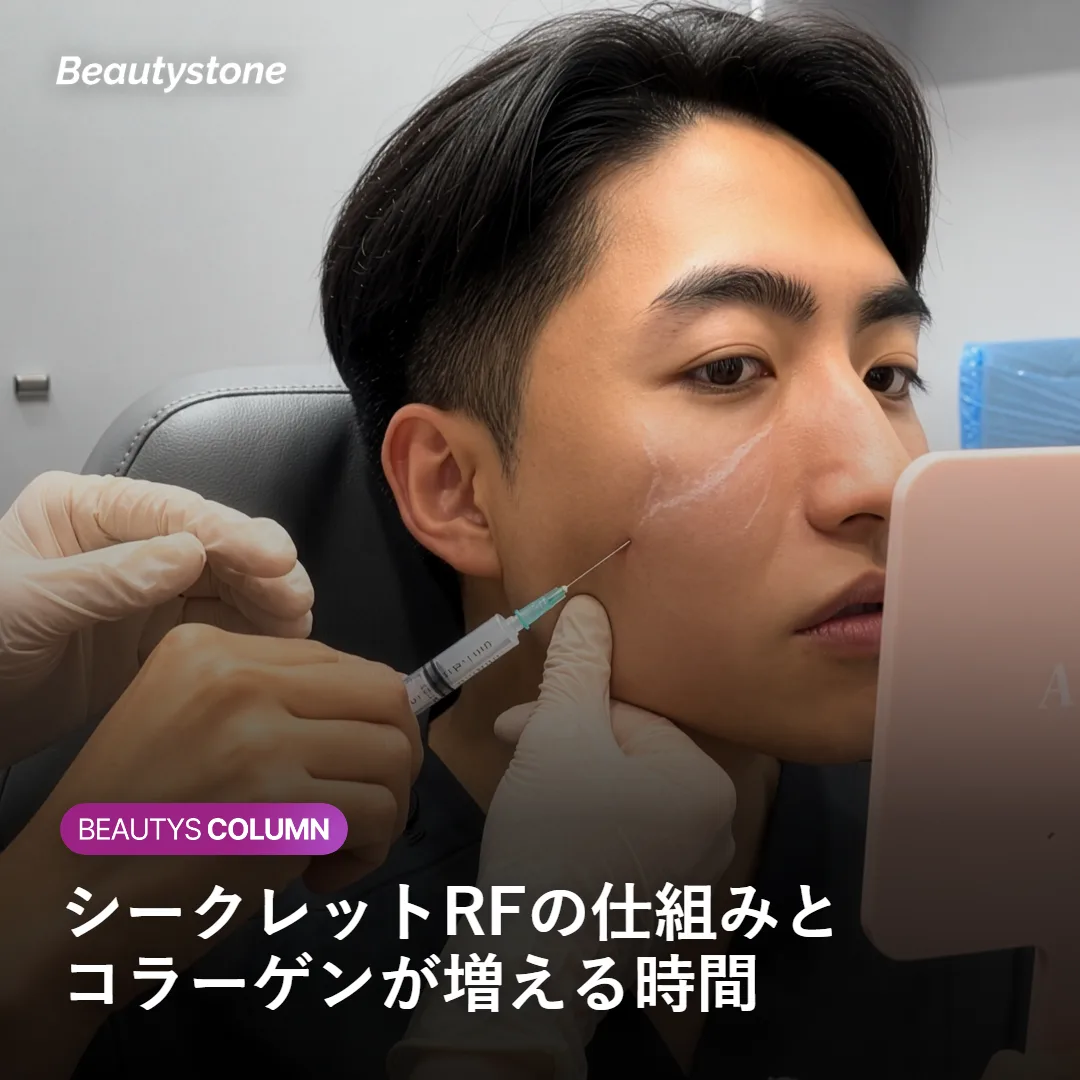 シークレットRFの仕組みとコラーゲンが増える時間を示す図