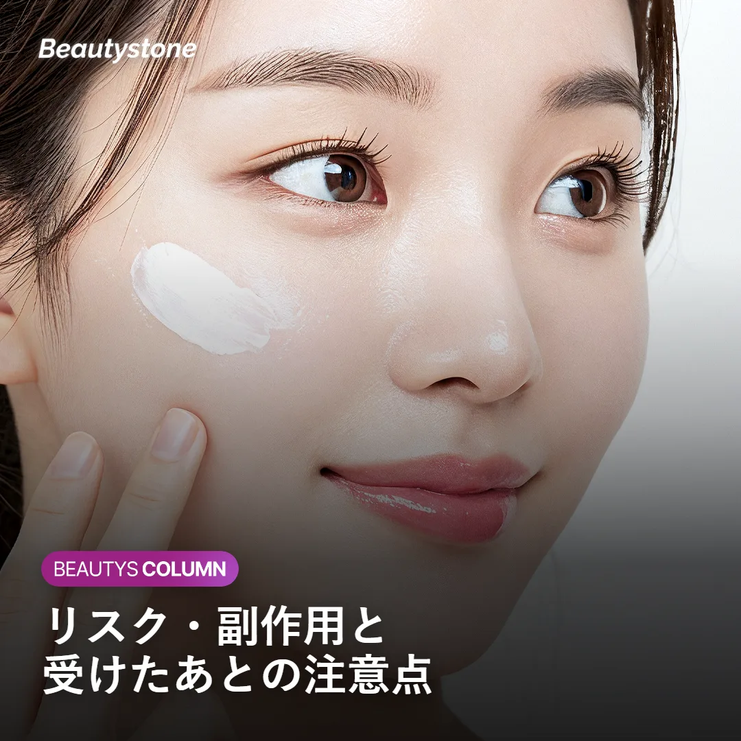 シークレットRFのリスク・副作用と受けたあとの注意点を示す図