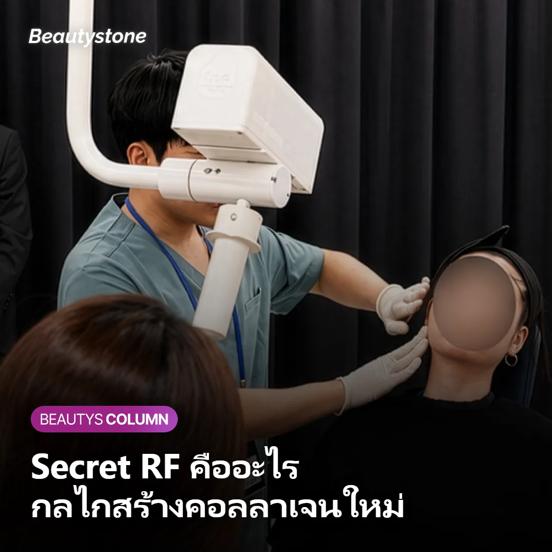 ภาพแสดงกลไกการสร้างคอลลาเจนใหม่ของ Secret RF ในชั้นหนังแท้