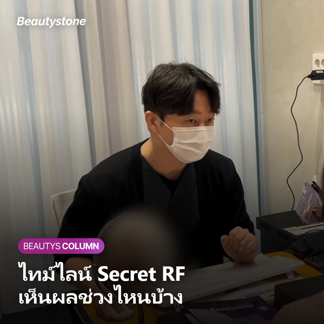 ภาพแสดงไทม์ไลน์ Secret RF ว่าเห็นผลช่วงไหนบ้าง