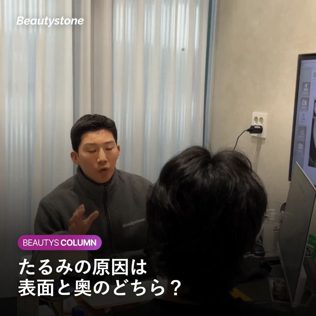 頬のたるみに関わる肌の層の断面を示す図