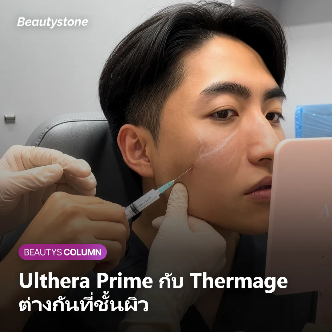 ภาพแสดงความต่างของชั้นผิวที่ Ulthera Prime และ Thermage ออกฤทธิ์