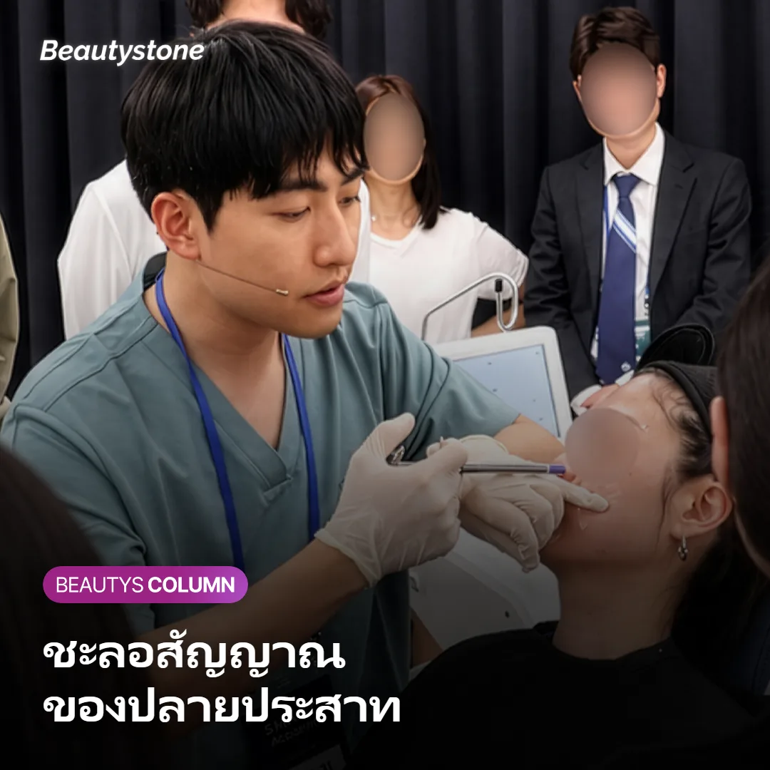 ภาพแสดงกลไกที่ยาชาแบบครีมชะลอการส่งสัญญาณของปลายประสาทชั่วคราว