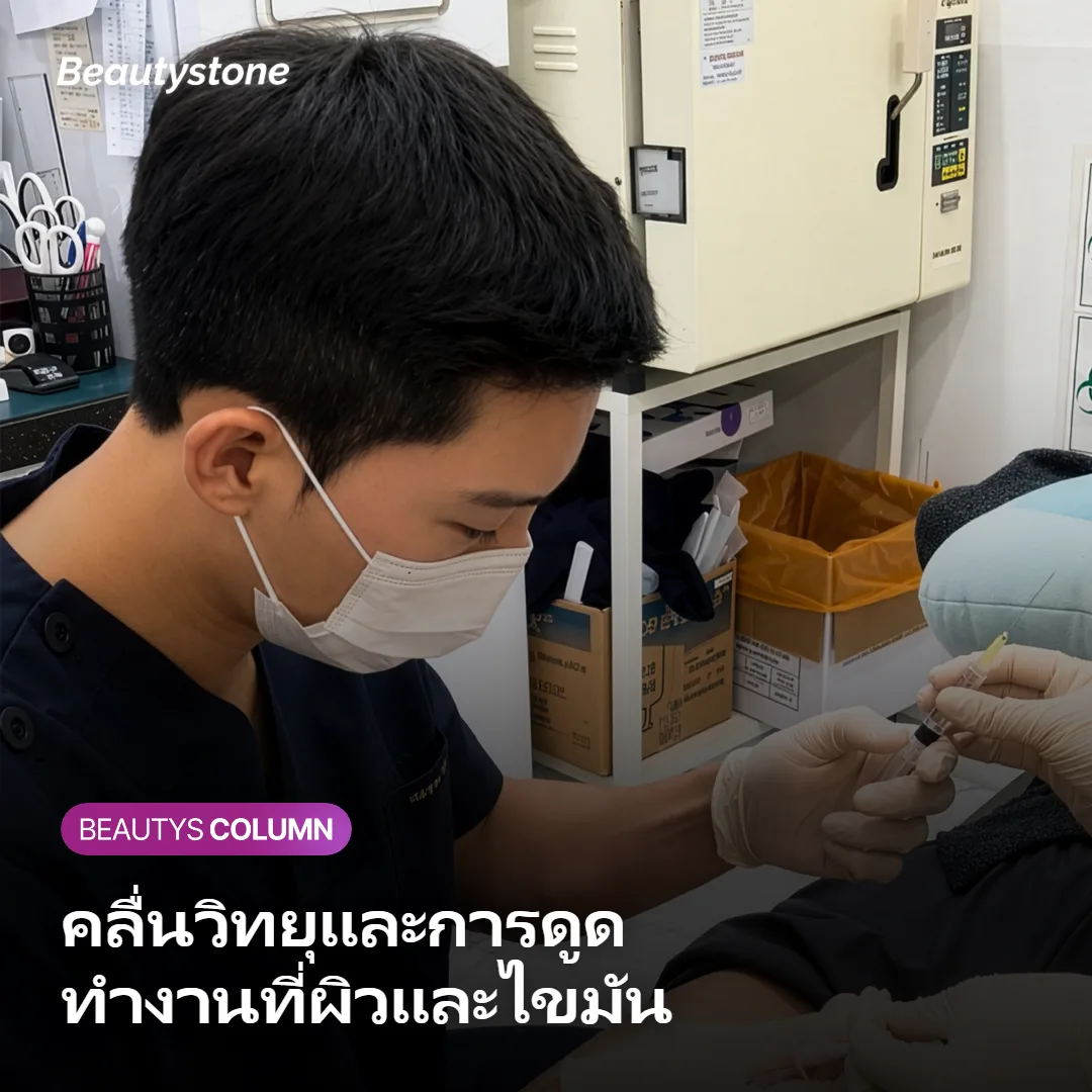 ภาพแสดงว่าคลื่นวิทยุและการดูดสุญญากาศของ InMode FX ทำงานที่ชั้นผิวหนังแท้และชั้นไขมันพร้อมกัน