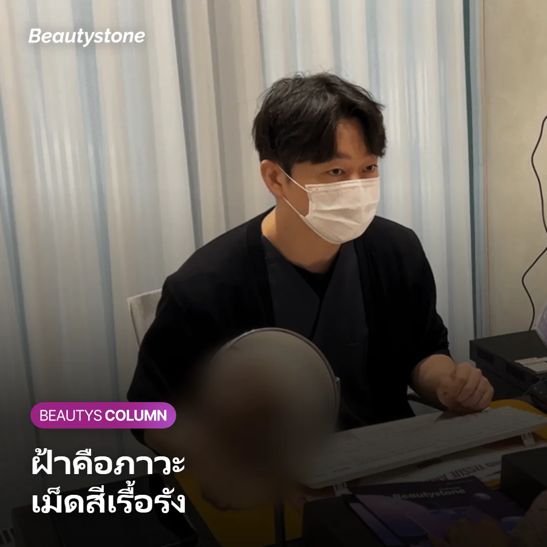 ภาพแสดงเซลล์เม็ดสีที่สร้างและกระจายเมลานินใต้ชั้นผิว