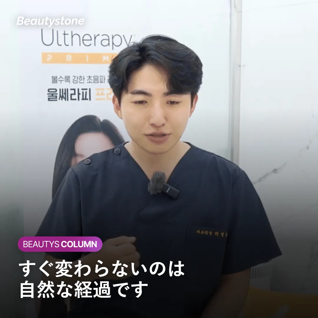 咬筋にボツリヌストキシンを注入する仕組みを示す図