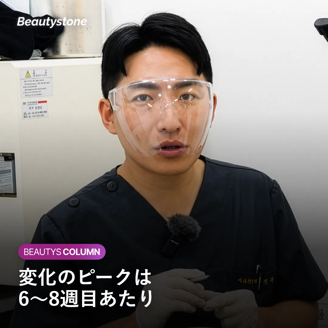 施術後2〜4週でフェイスラインが変化する経過を示す図