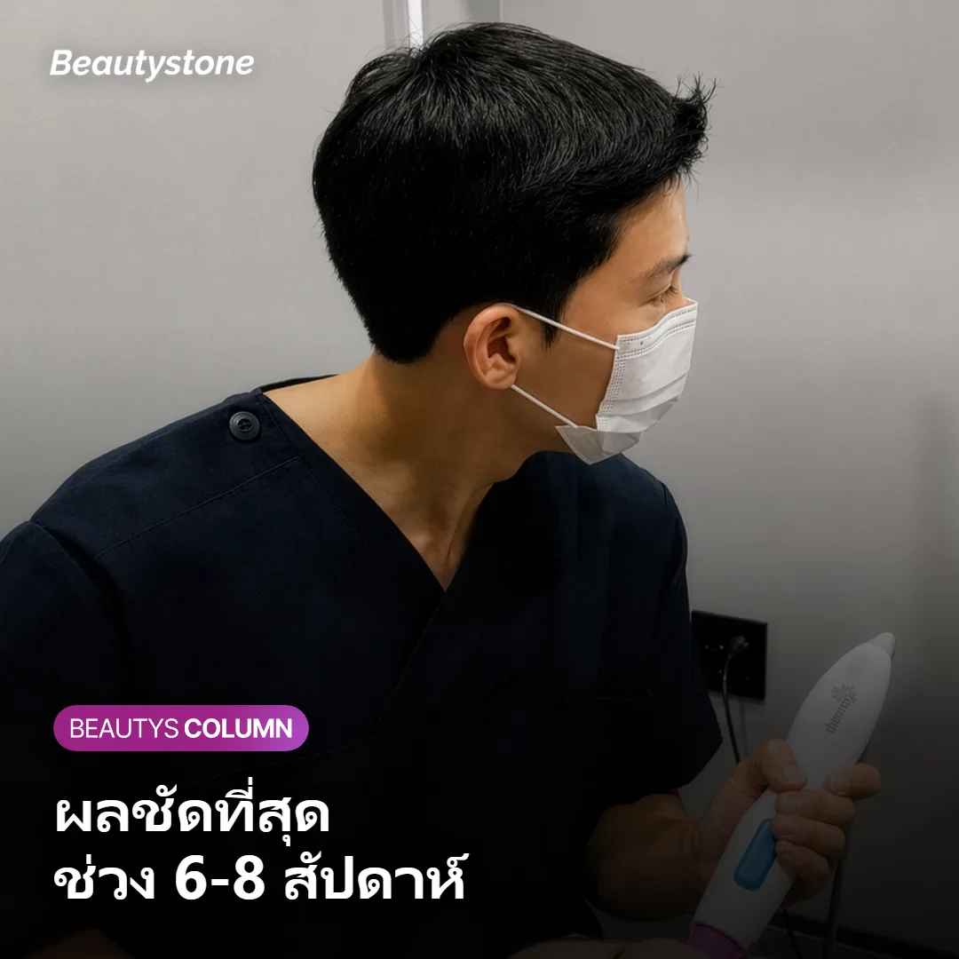 ภาพแสดงไทม์ไลน์การเปลี่ยนแปลงของกรอบหน้าใน 2-4 สัปดาห์หลังฉีด