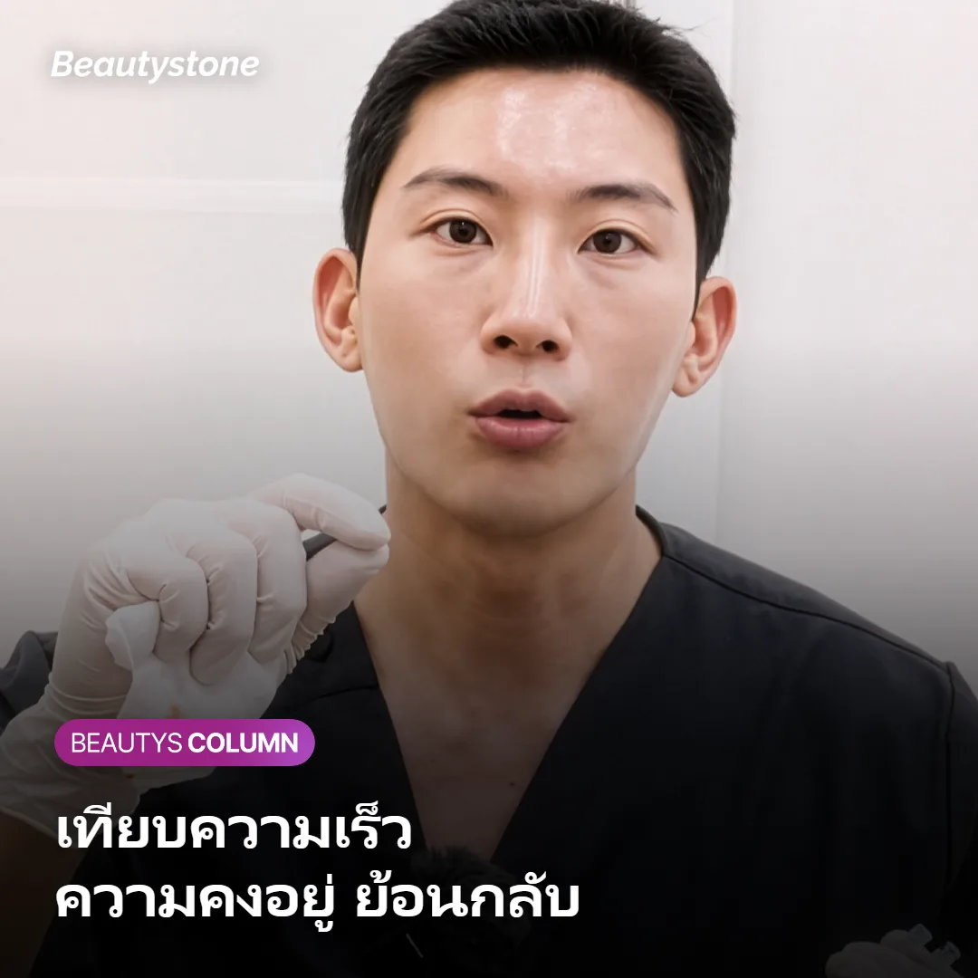 ภาพแสดงเกณฑ์เปรียบเทียบสารเติมวอลุ่มด้านความเร็ว ความคงอยู่ และการย้อนกลับ
