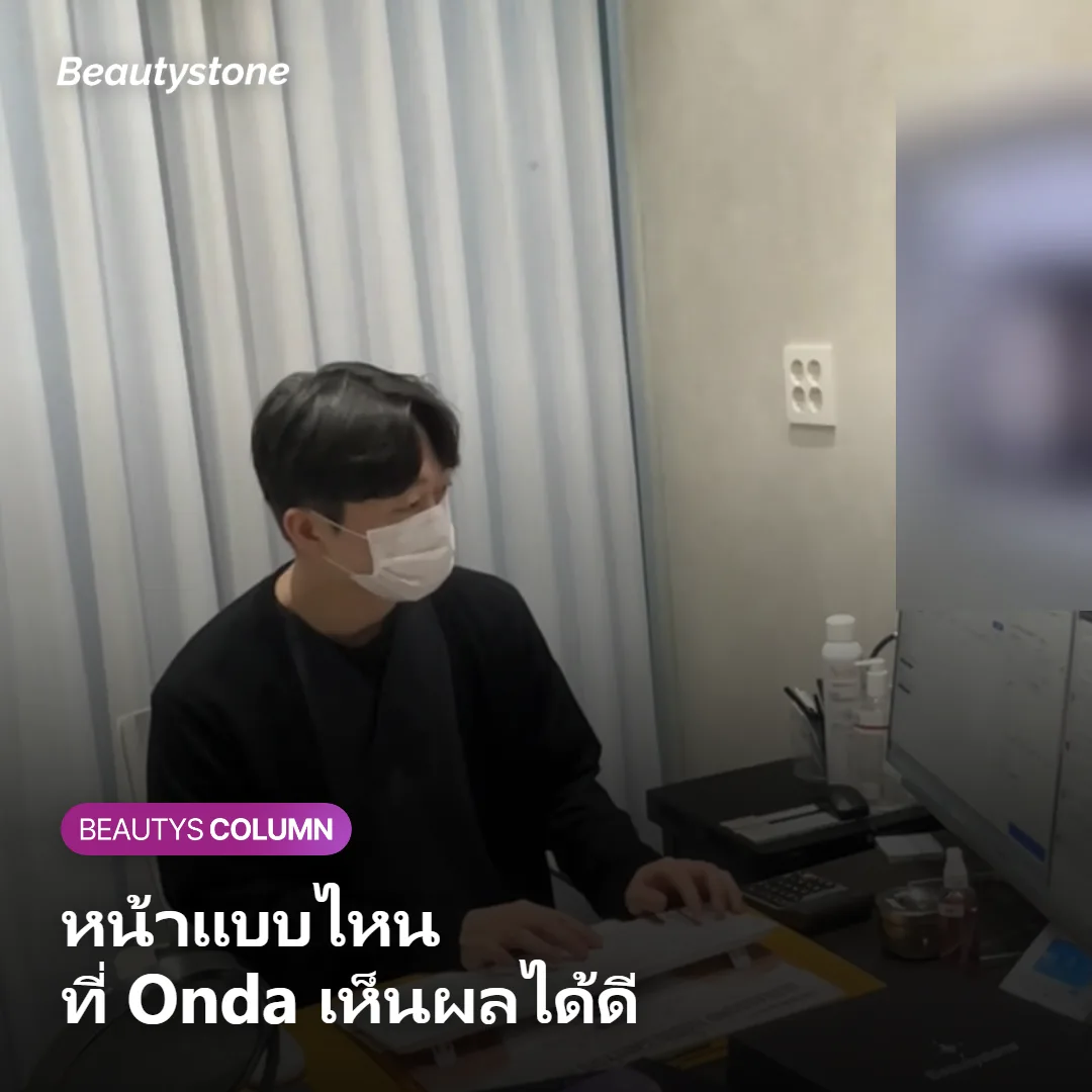 ภาพแสดงลักษณะหน้าที่ Onda เห็นผลได้ดี
