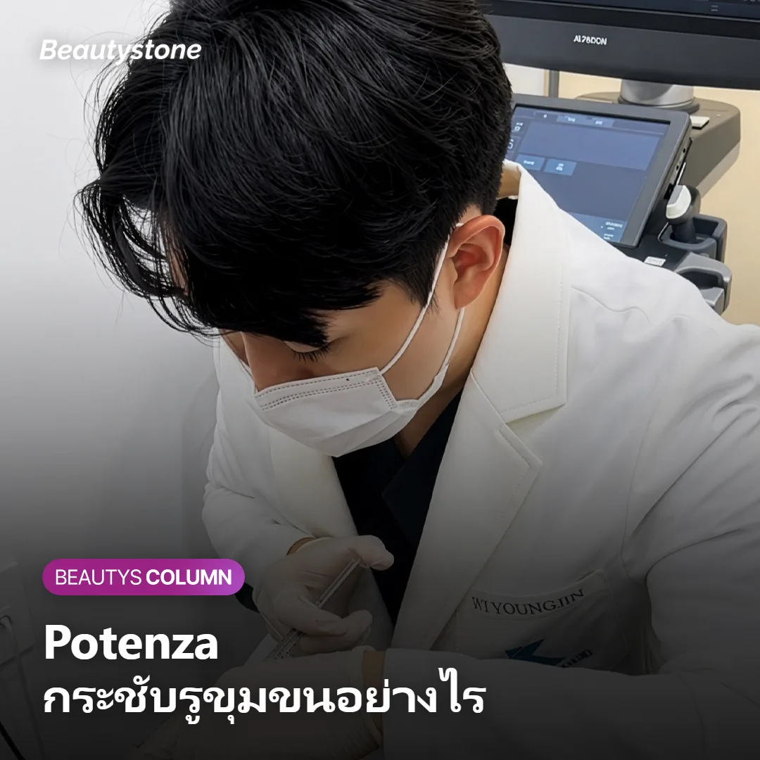 ภาพแสดงกลไกที่ Potenza ใช้ความร้อนในชั้นหนังแท้กระชับรูขุมขน