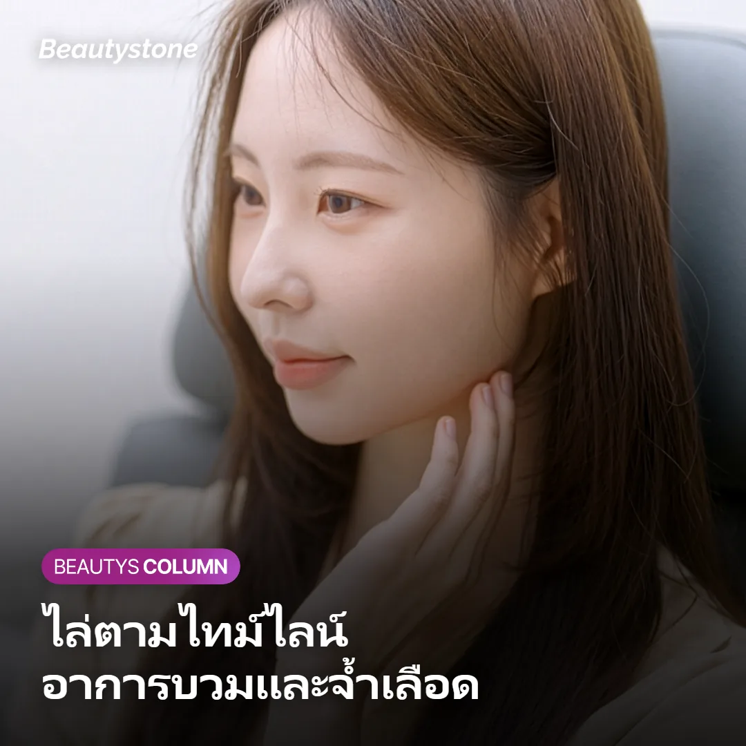 ภาพแสดงอาการบวมและจ้ำเลือดค่อย ๆ ยุบและจางลงภายในหนึ่งถึงสองสัปดาห์