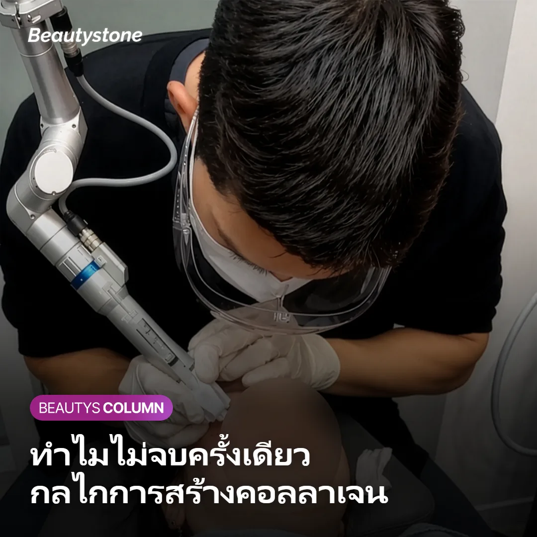 ภาพแสดงกลไกที่ความร้อนจากคลื่นความถี่สูงส่งถึงคอลลาเจนในชั้นผิวหนังแท้