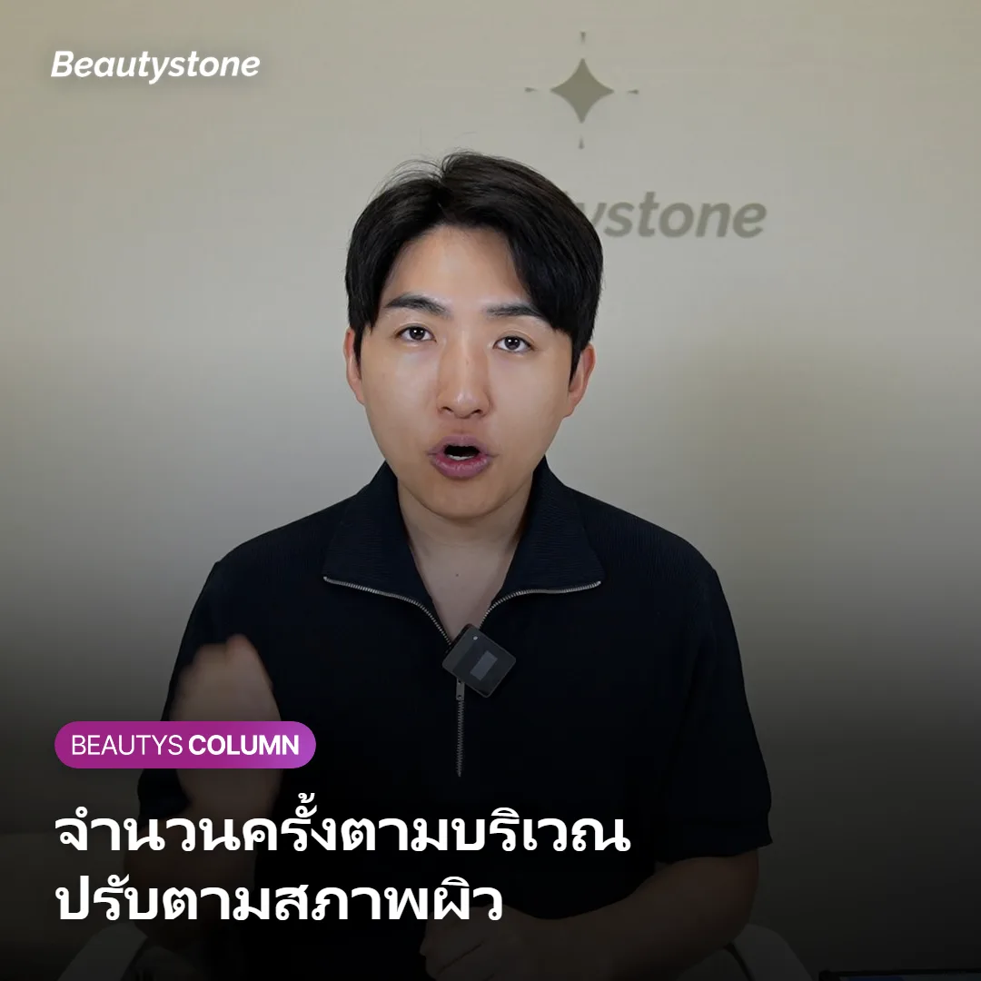 ภาพแสดงจุดที่ทำให้จำนวนครั้งของ Onda แตกต่างกันตามบริเวณ
