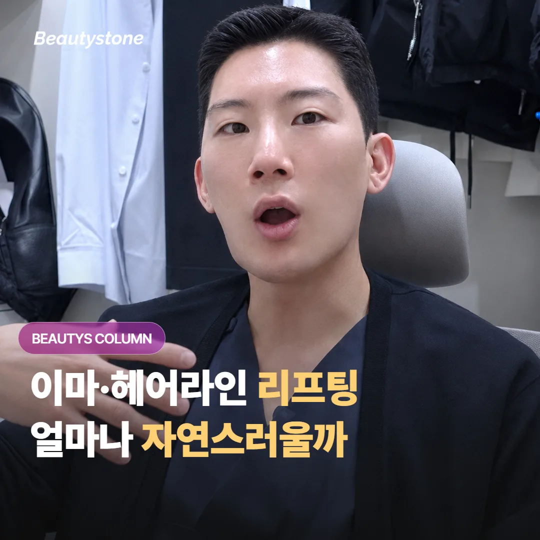 소프웨이브로 이마와 헤어라인을 올리면 처진 느낌이 얼마나 자연스럽게 잡히고 오래갈까요?