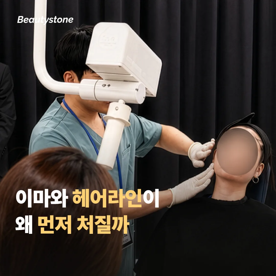 이마와 헤어라인, 왜 먼저 늘어질까요?
