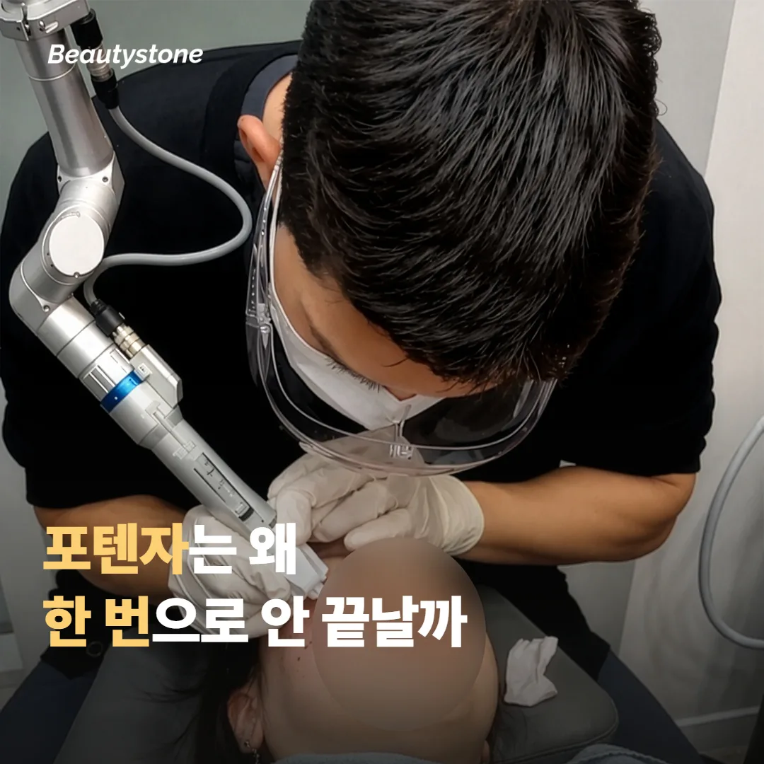 포텐자, 왜 한 번으로 끝나지 않을까요?