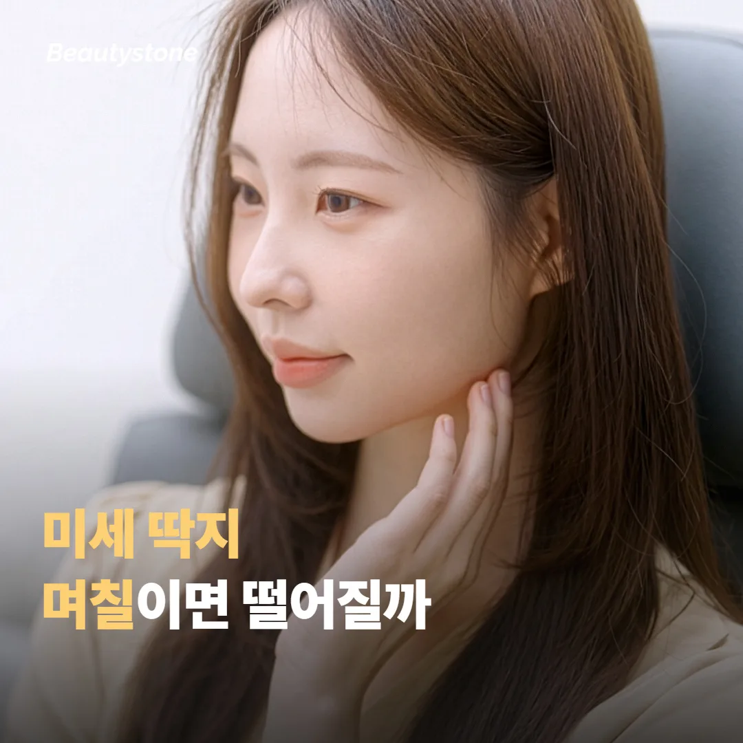 미세 딱지는 며칠이면 떨어지나요