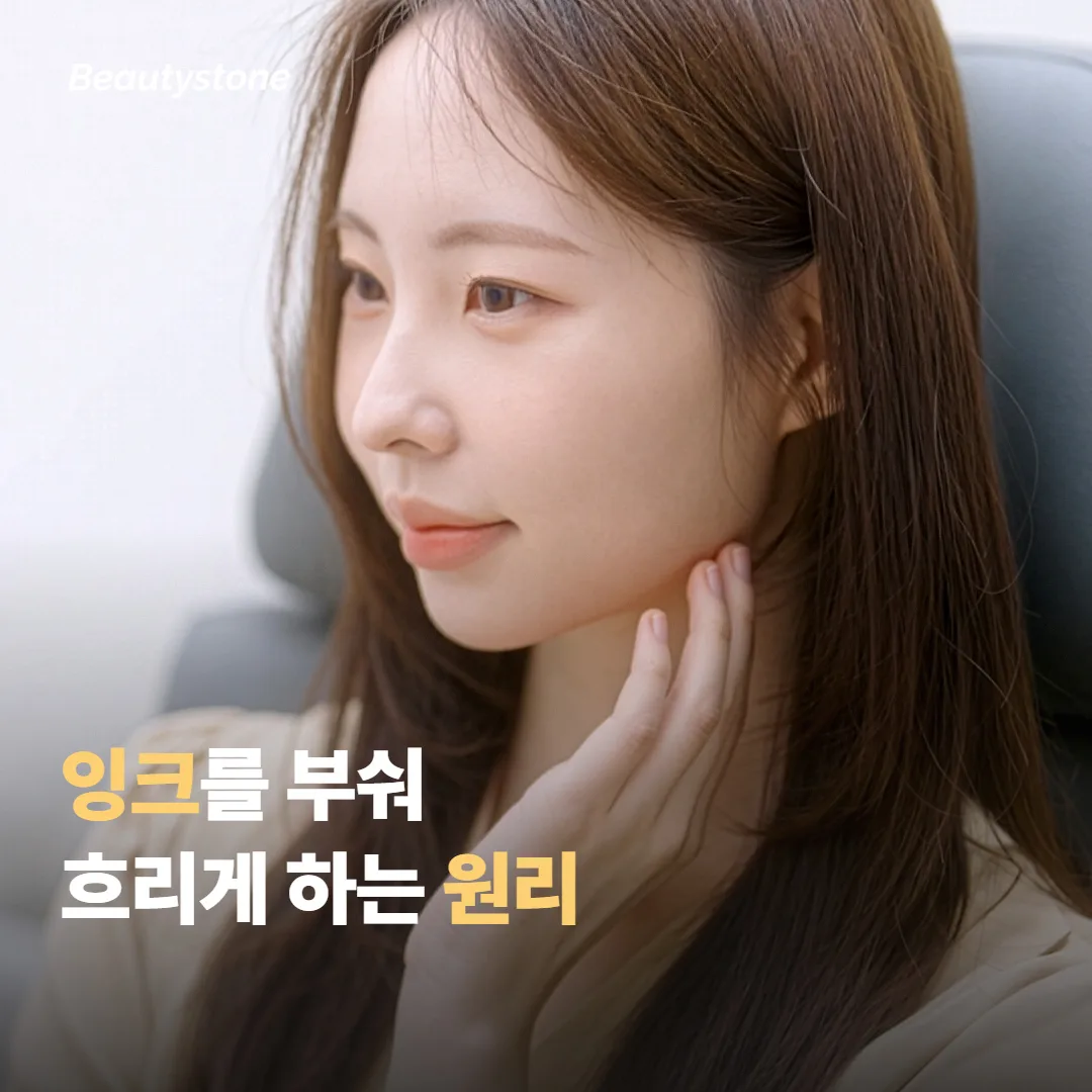 피코웨이는 어떻게 문신을 흐리게 만들까요