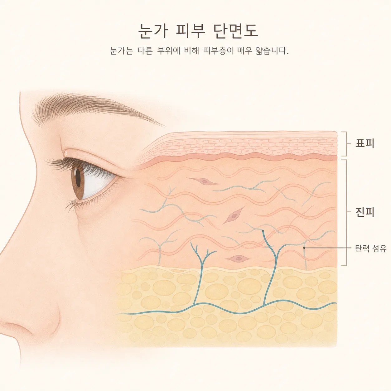 눈 둘레의 얇은 표피·진피와 그 아래 탄력 섬유층