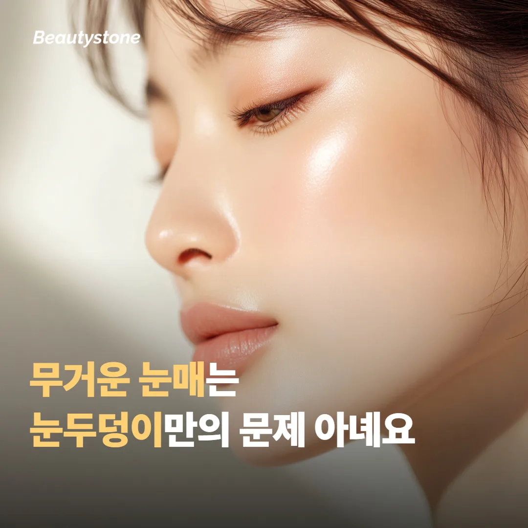 눈매가 무거워 보이는 건 눈두덩이만의 문제가 아니에요