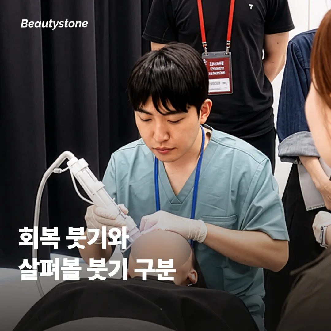 아침 붓기와 오래 지속되는 붓기는 어떻게 다를까요