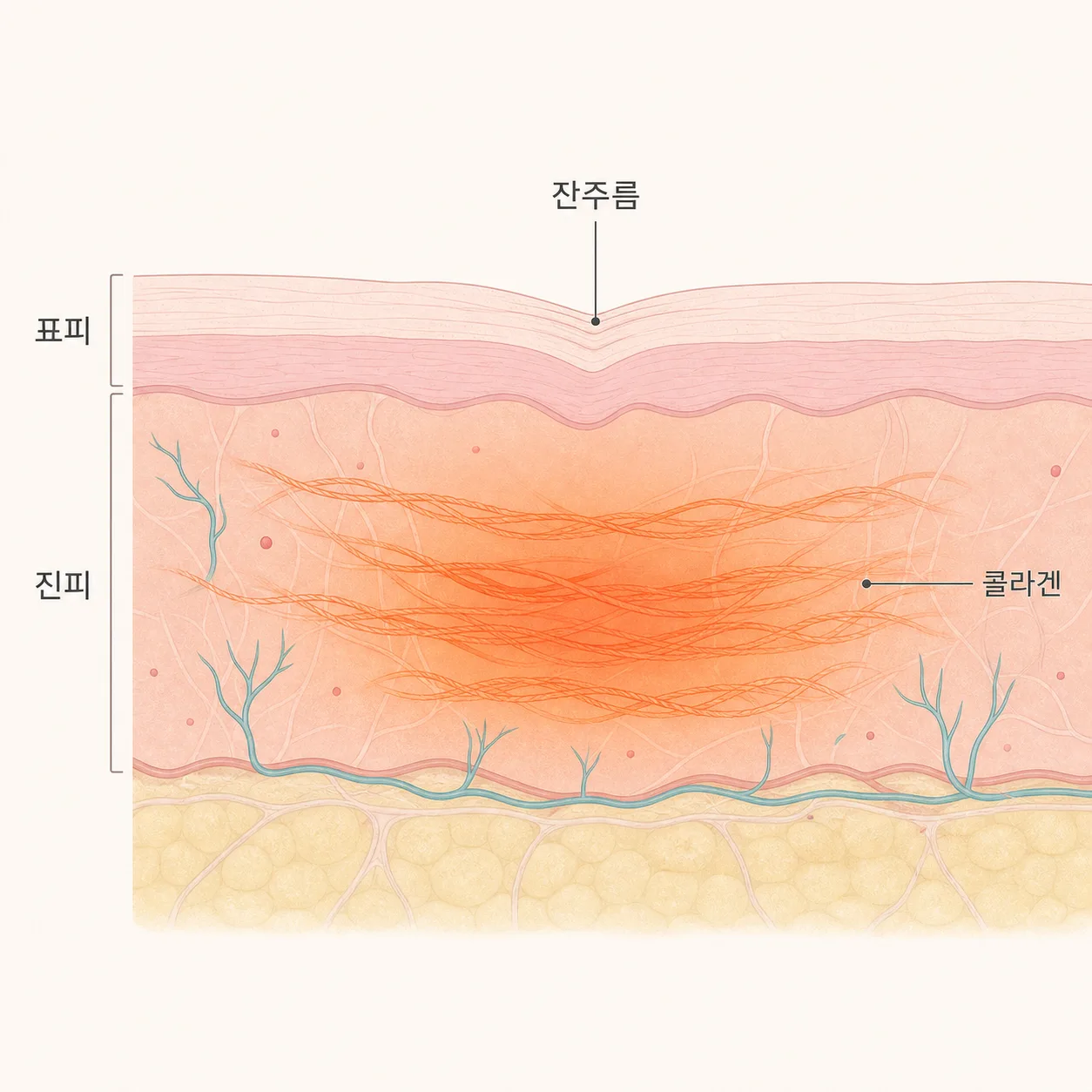 잔주름은 표면 가까이, 탄력 저하는 진피의 콜라겐에서 비롯돼요