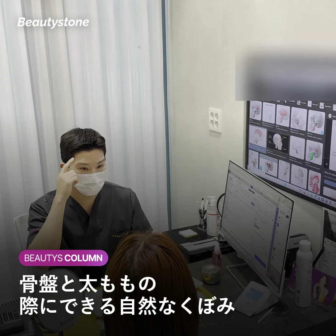 骨盤と太ももの境目にできるヒップディップの構造を示す図